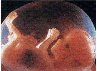 CHI LO VUOLE UCCIDERE?
Appunti per una battaglia culturale
contro l'aborto
